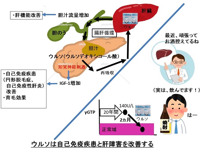 円形脱毛症　病院